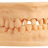 Nahaufnahme eines hochpräzisen Dentalmodells aus beigem IMPRIMO® LC Model Harz.