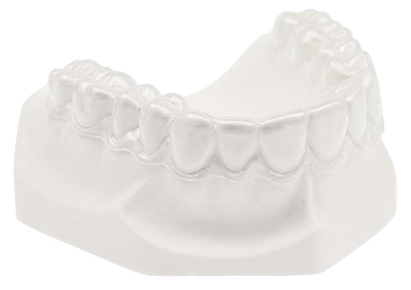 Hochtransparente dentaler Retainer auf Modell eines menschlichen Gebisses.