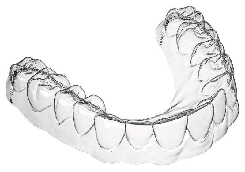 Transparente Zahnschiene aus CA® Folie 100er Soft für Zahnkorrekturen.