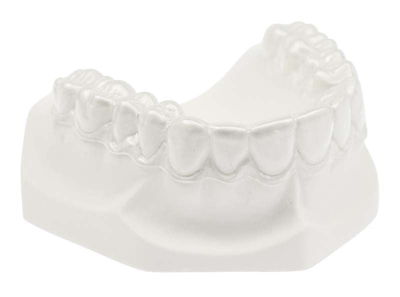 Zahntechnisches Modell mit Miniplast-Schiene aus IMPRELON® S pd Material.