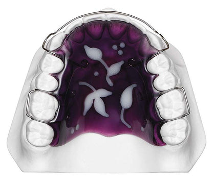 Kieferorthopädische Zahnspange mit violettem STEADY-RESIN Farbmonomer und kunstvollen Mustern.