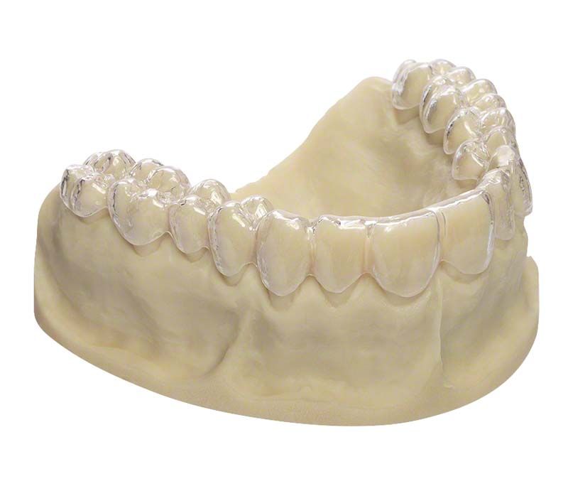 Transparente Aligner-Schiene auf Zahnmodell montiert