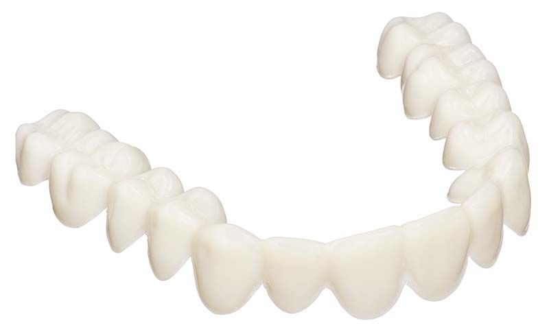 Zahnfarbene Schiene aus DURAN®+ A2 Tiefziehfolie für Aligneranwendungen.