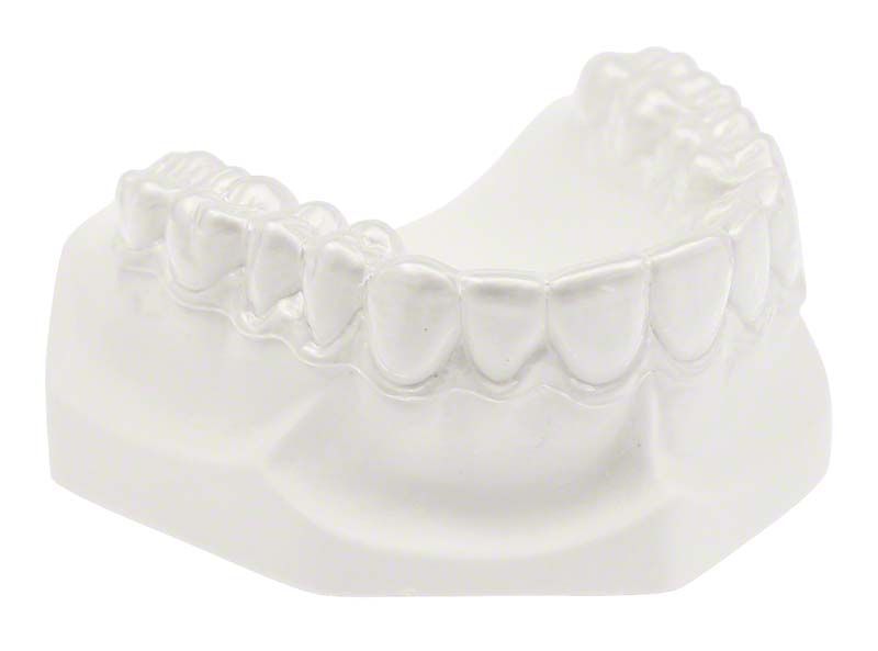 Modell einer Zahnschiene für dentale Anwendungen.