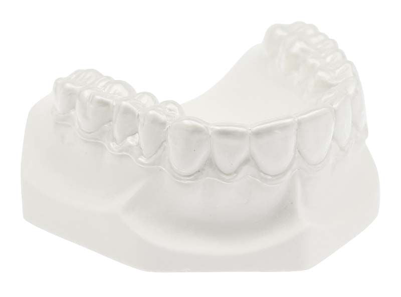 Dentales Modell einer Aufbiss-Schiene aus IMPRELON® S pd Material.