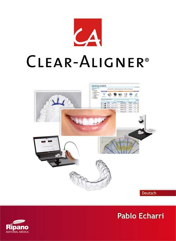 CA®Fachbuch von Dr. Echarri über Clear-Aligner mit Bildern und Diagrammen.