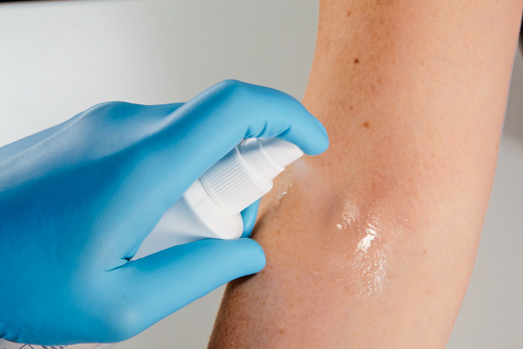 Blaue behandschuhte Hand sprüht Cutasept F auf Armhaut.