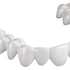 DURAN®+ white pd 0,5mm