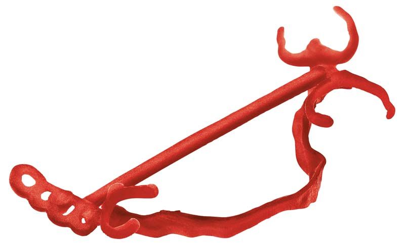 Roter dentaler Gussobjektrahmen aus IMPRIMO® LC CAST Harz.