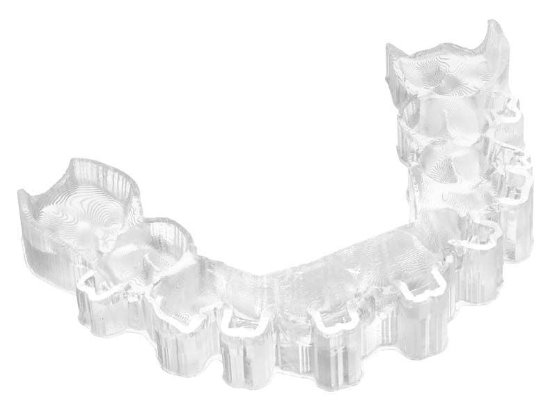 Transparente Transfermatrize aus lichthärtendem Harz für kieferorthopädische Apparaturen.