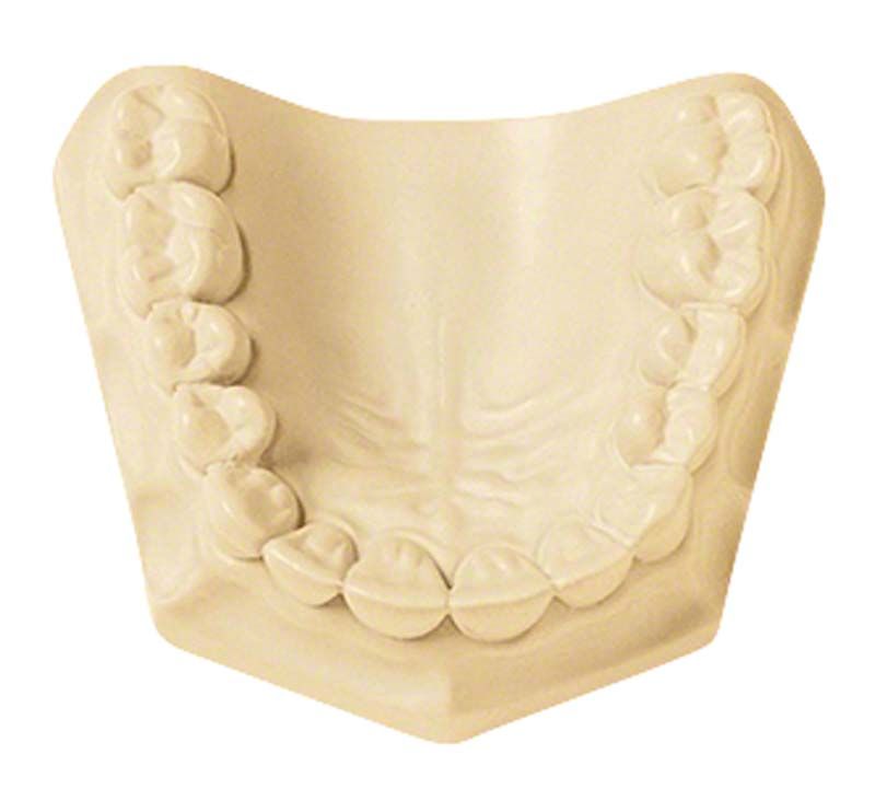 Superhartgips-Modell in Elfenbeinfarbe für dentalen Gebrauch