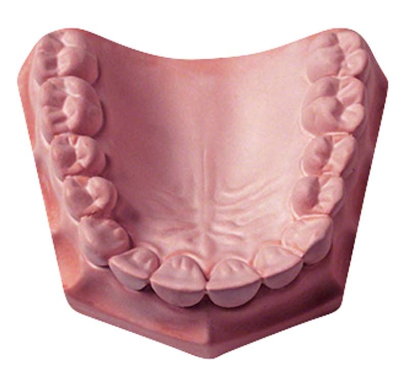 Silky-Rock Superhartgips 15kg in hellbrauner Zahnbogen-Form.