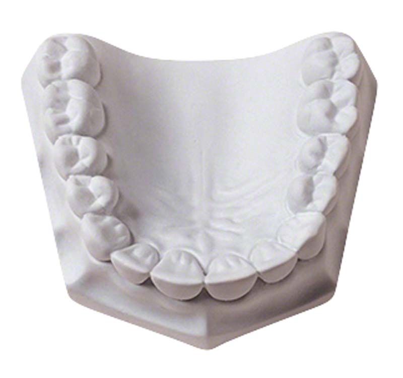 Dentalmodell aus Silky-Rock Superhartgips für Zahntechnik.