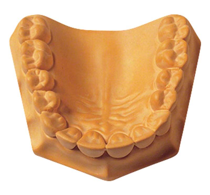 Silky-Rock Superhartgips Dentalmodell in Gelb.