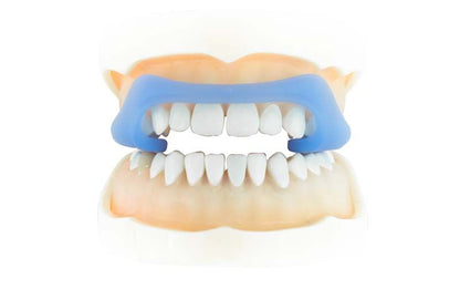 RehaSplint Hart Aufbissschiene auf Modellkiefer zur CMD-Behandlung.