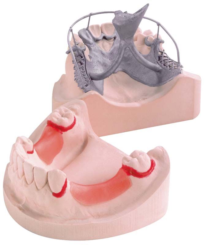 Detailansicht eines Zahntechnik-Modells aus OCTA-STONE M Superhartgips in Rosa.