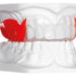 BIOPLAST® XTREME Kit rot