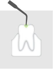 Piezo-Spitze mit Spitzenwechsler für Restauration und Prothetik.