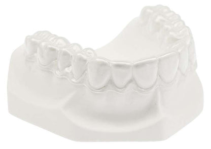 Hochtransparente dentaler Retainer auf Modell eines menschlichen Gebisses.