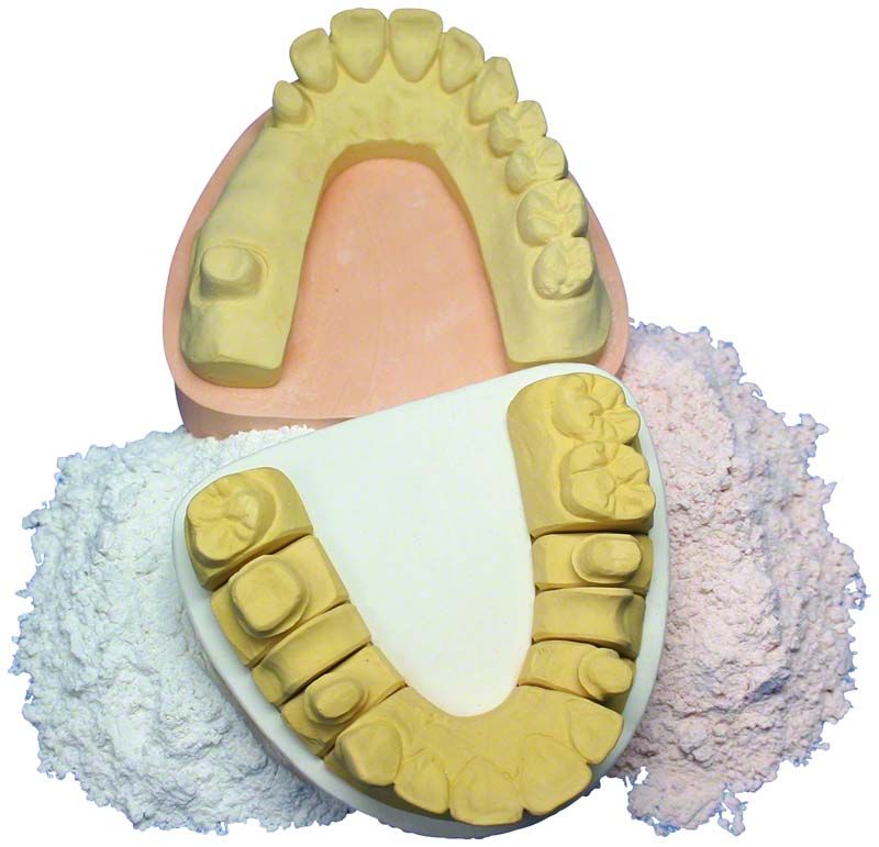 Sockelgips Natur weiß mit dentalem Modell und Gipsabdruck.