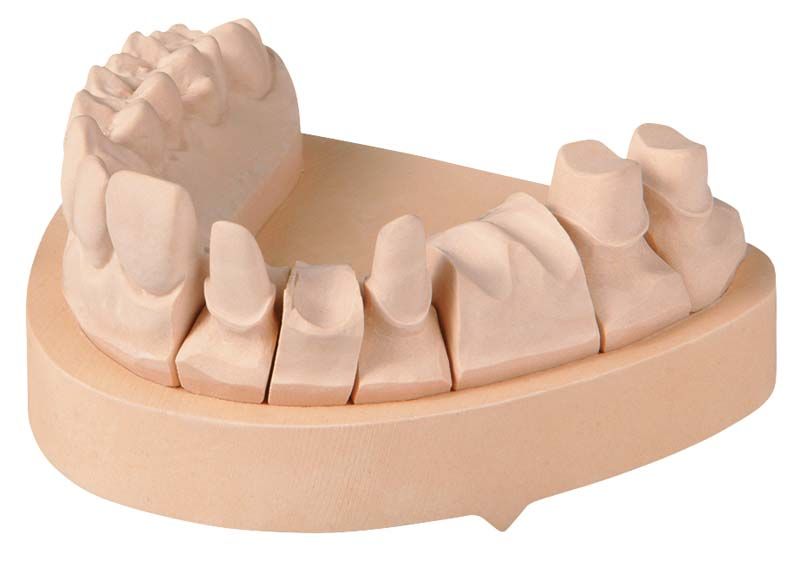 OCTA-STONE CN champagner Zahnmodell mit detaillierter Darstellung der Zahnkronen.