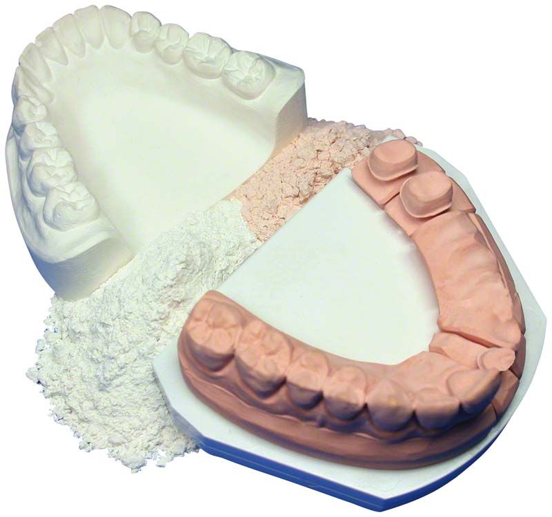 Zwei dentaltechnische Modelle aus SH 074 Superhartgips, weiß und rosa.