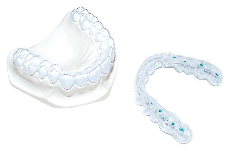 Transparente dental Schienen aus DURASOFT® pd Material auf weißem Hintergrund.