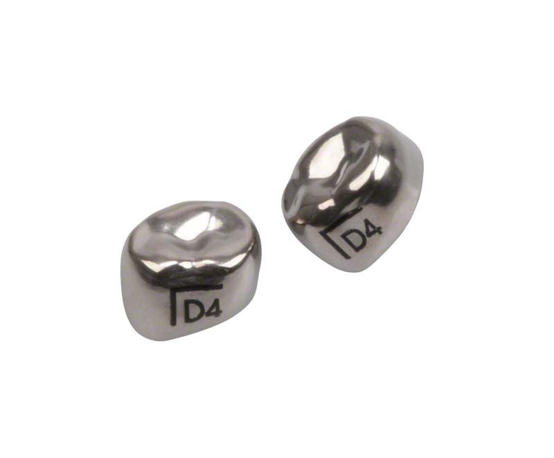 Edelstahlkronen für Milchzahnmolaren, Nahaufnahme des zervikalen Federrands.