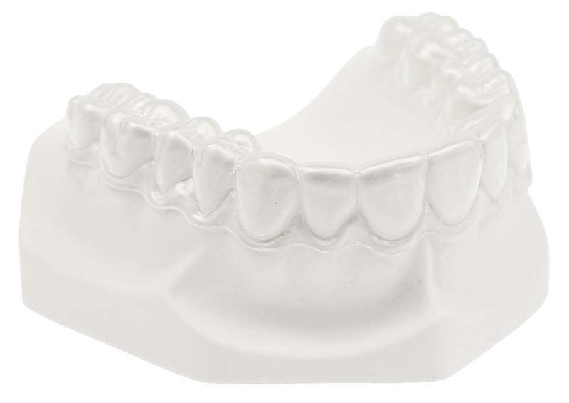 Zahnmodell aus COPYPLAST® C 1,0mm mit detaillierter Zahndarstellung.