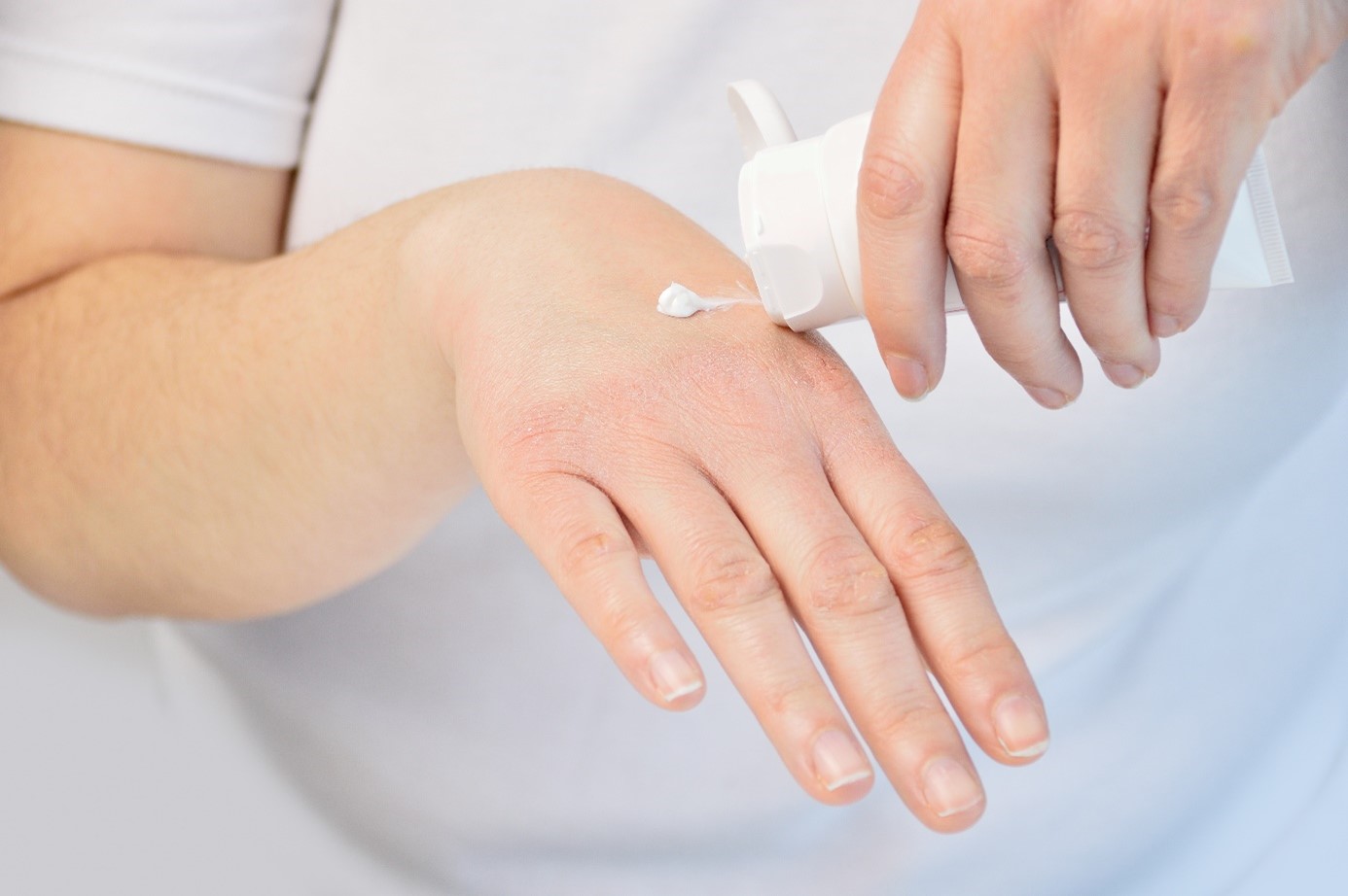Hautpflege mit Handcreme